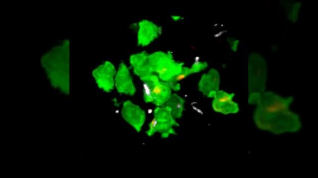 Cluster of IFN-gamma-producing T cells смотреть онлайн