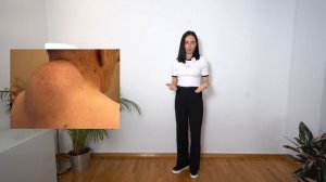 Чем опасна ХОЛКА НА ШЕЕ и как её УБРАТЬ_ Причины возникновения горбика на шее, которые ВАЖНО знать