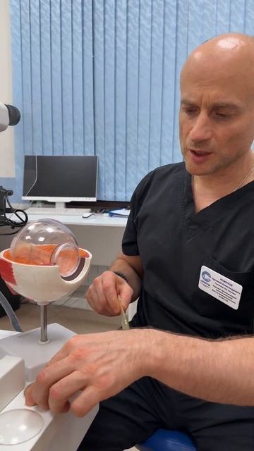 Факичные линзы - альтернатива лазерной коррекции зрения. смотреть онлайн