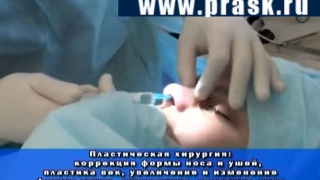 Ринопластика смотреть онлайн