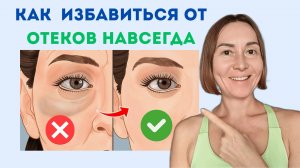 МЕШКИ, Отеки и ПРОВАЛЫ под глазами уйдут НАВСЕГДА! ОДИН простой способ