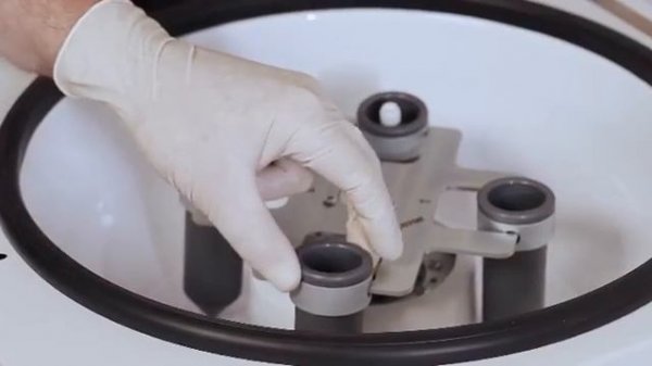 cortexil с плазмой