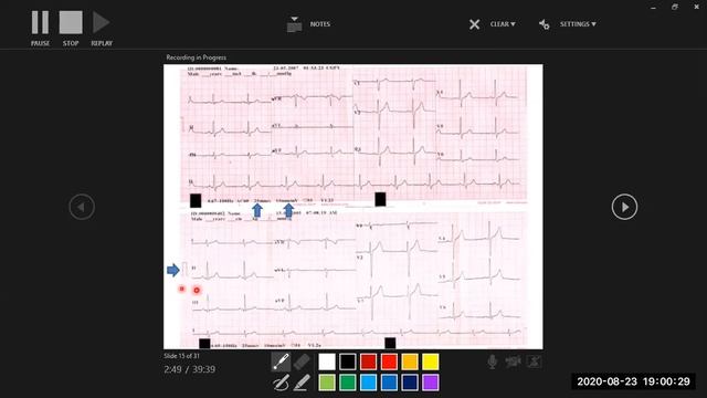 Cardiovascular 1 Heart смотреть онлайн