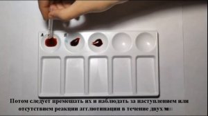 Определение группы крови с помощью цоликлонов