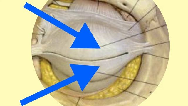 4. Отличия чек-лифтинга от нижней блефаропластики. Чек-лифтинг в клинике Пульс Архангельск смотреть онлайн