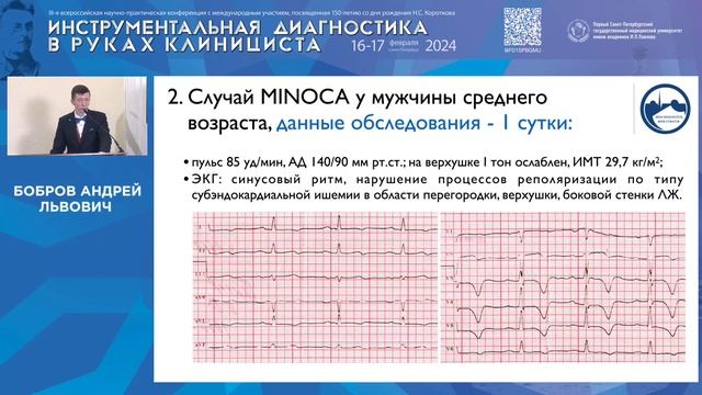 Роль эхокардиографии в диагностике инфаркта миокарда без обструктивного поражения коронарных артери смотреть онлайн