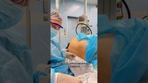 Как ставят спинальную, эпидуральную анестезию во время родов