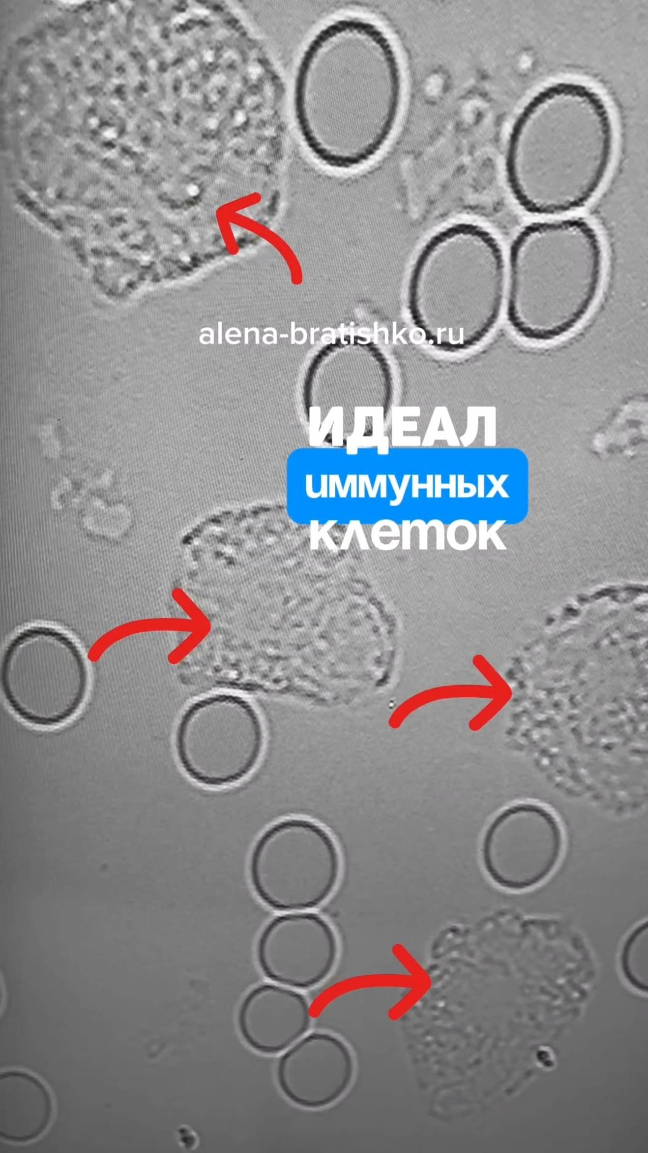 Идеал иммунных клеток. С такии иммунитетом человек здоров в любой сезон смотреть онлайн