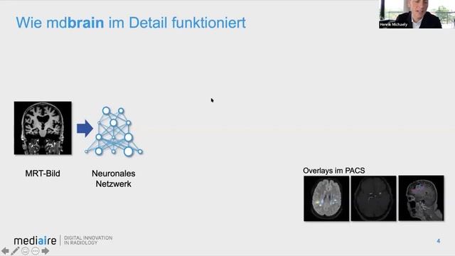 KI in der Neuroradiologie - Mitschnitt vom Röntgenkongress 2021 смотреть онлайн