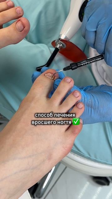 Ещё больше о здоровье ногтей и стоп у нас на канале. Подписывайтесь ✔️ смотреть онлайн