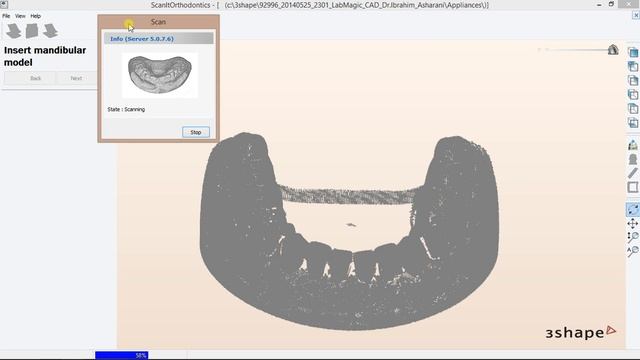 Digital Orthodontic Models Scanning смотреть онлайн