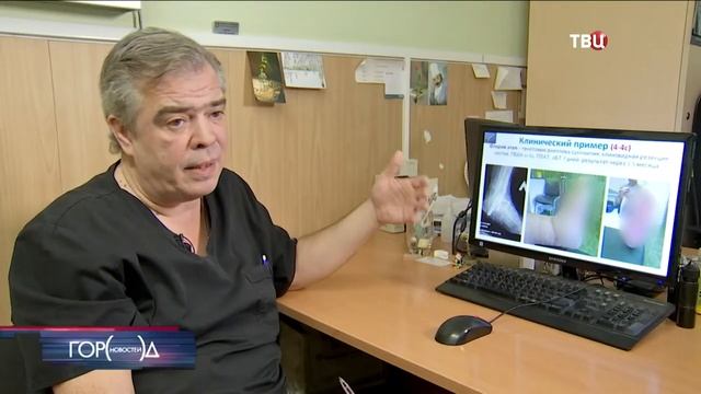 Центр спасения конечностей в Москве уже помог десяткам пациентов смотреть онлайн