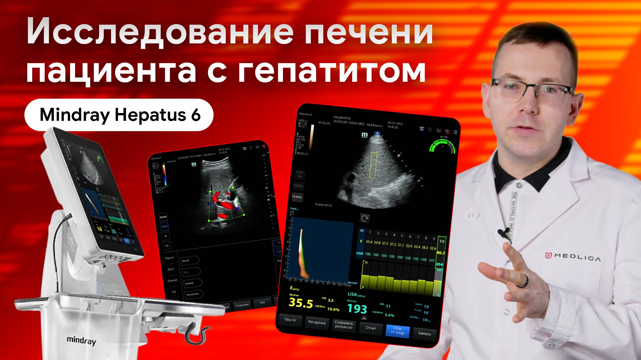 Исследование пациента с хроническим гепатитом на Mindray Hepatus 6