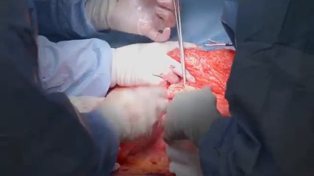 Botched Bariatrics S01E02