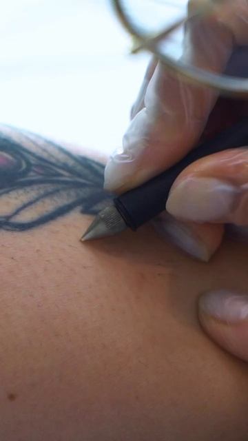 Электроэпиляция в Epil Story!✨ #лазернаяэпиляция #депиляция #электроэпиляция #косметология смотреть онлайн