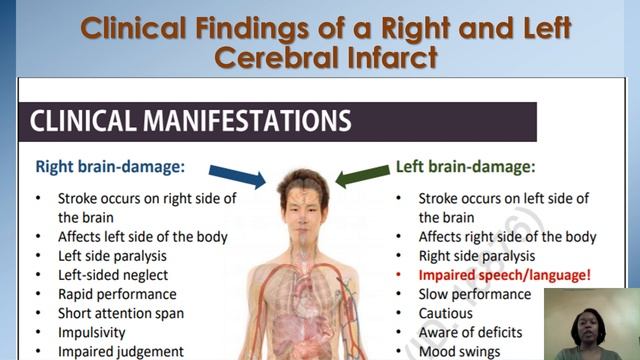 Cerebral Infarct PPT 10 20 22 смотреть онлайн