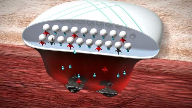 Повязка Гидроклин плюс (HydroClean Plus)