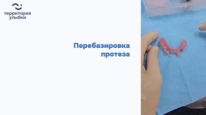 Перебазировка протеза