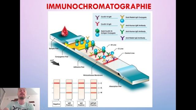 Sujet 9. Diagnostic Virologique