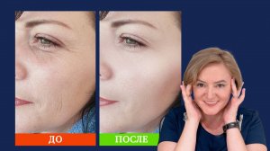 Омоложение Лица После 40 лет
