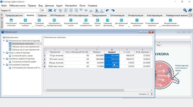 ПО СтатСофт | Анализ данных — Глаукома