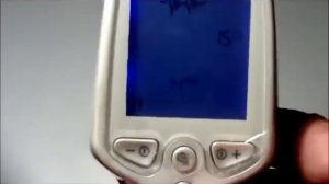 Правила пользования аппарат акупунктуры Восточный лекарь