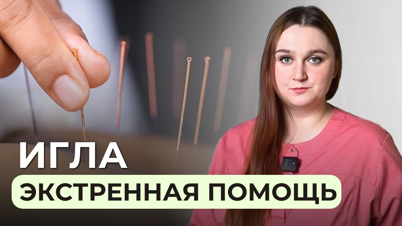 Иглоукалывание: Как снять острую боль в спине иглорефлексотерапией? смотреть онлайн