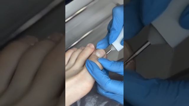 Медицинский педикюр смотреть онлайн