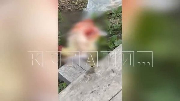 Отрезанную ногу нашли в центре Лукоянова Виновата врачебная халатность