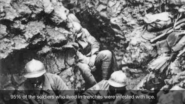 Trench Warfare iMovie смотреть онлайн