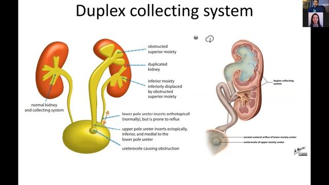 Renal Imaging Part 2 | RadX Teaching Series смотреть онлайн