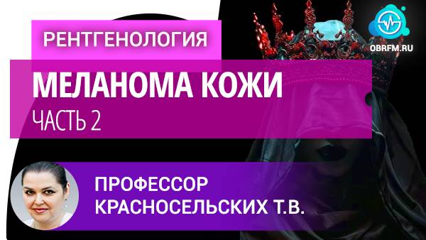 Профессор Красносельских Т.В.: Меланома кожи. Часть 2 смотреть онлайн