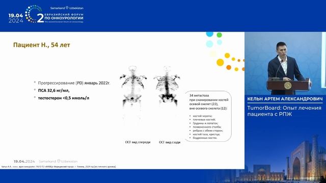 TumorBoard: Опыт лечения пациента с РПЖ. Кельн А. А. смотреть онлайн
