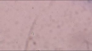 Darting motility of bacteria Positive ||Vibrio cholerae ||Campylobacter jejuni