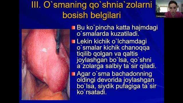 Bachadon miomasi смотреть онлайн