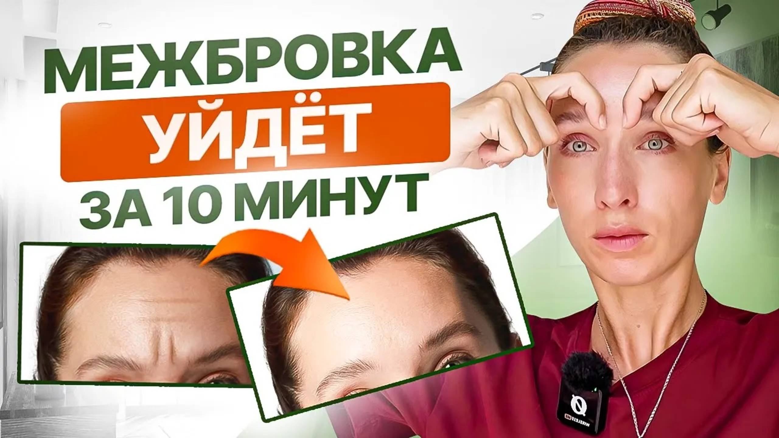 Эффект СРАЗУ | ЭТИ 5 упражнений от межбровных морщин работают лучше ботокса смотреть онлайн