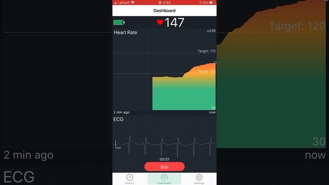 ViHealth app - using ViAtom chest strap to measure heart rate смотреть онлайн