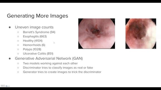 GastroScan Video Presentation смотреть онлайн