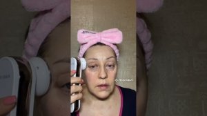 RF/LED многофункциональный аппарат для омоложения кожи IntelliDerm SolutionsTM компании МЭРИ КЭЙ