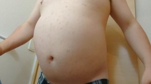 Helium belly inflation