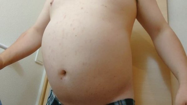 Helium belly inflation