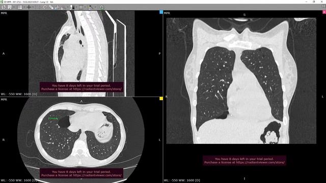 Школа пульмонологов смотреть онлайн