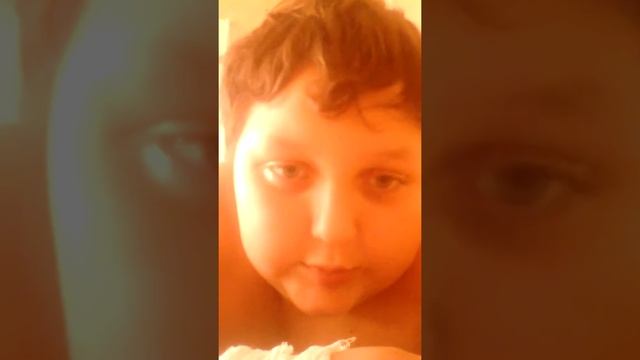 Я сломал руку но недавно сгяли