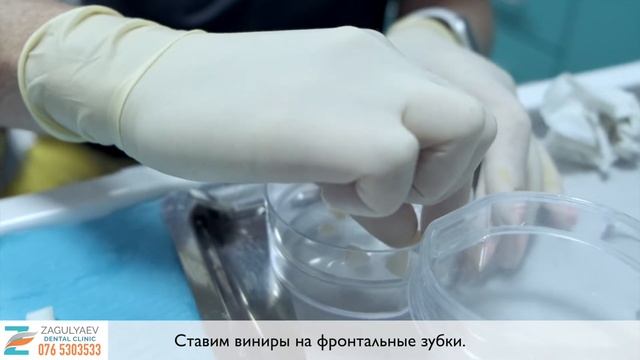 Отзыв : эстетическая стоматология в клинике Доктора Загуляева