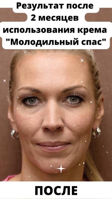 ПОРАЗИТЕЛЬНОЕ ОМОЛОЖЕНИЕ! 🔥 Смотреть обязательно! 😳 |  Крем 