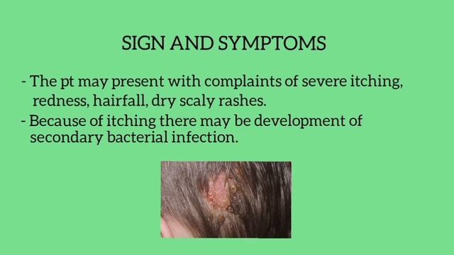 Tinea Capitis | Causes | Complaints| Treatment ⚕️⚕️ смотреть онлайн