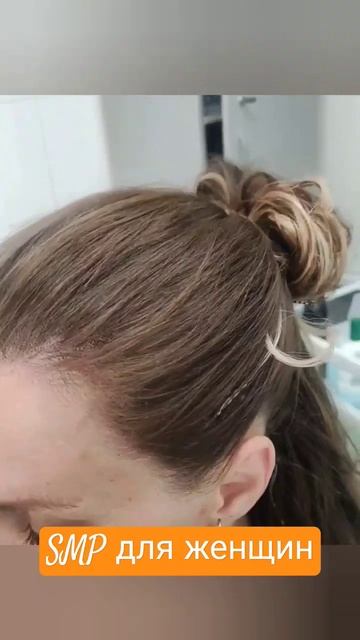 Микропигментация кожи головы SMP для женщин. Техника 