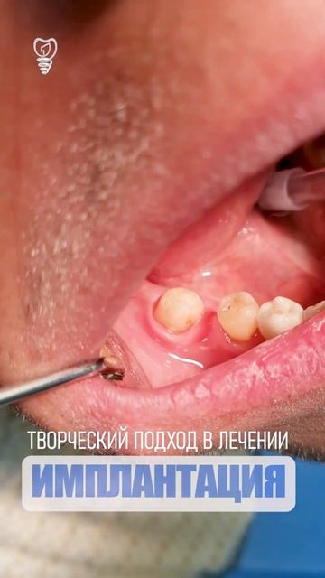 Творческий подход в лечении. Creative approach to treatment. смотреть онлайн