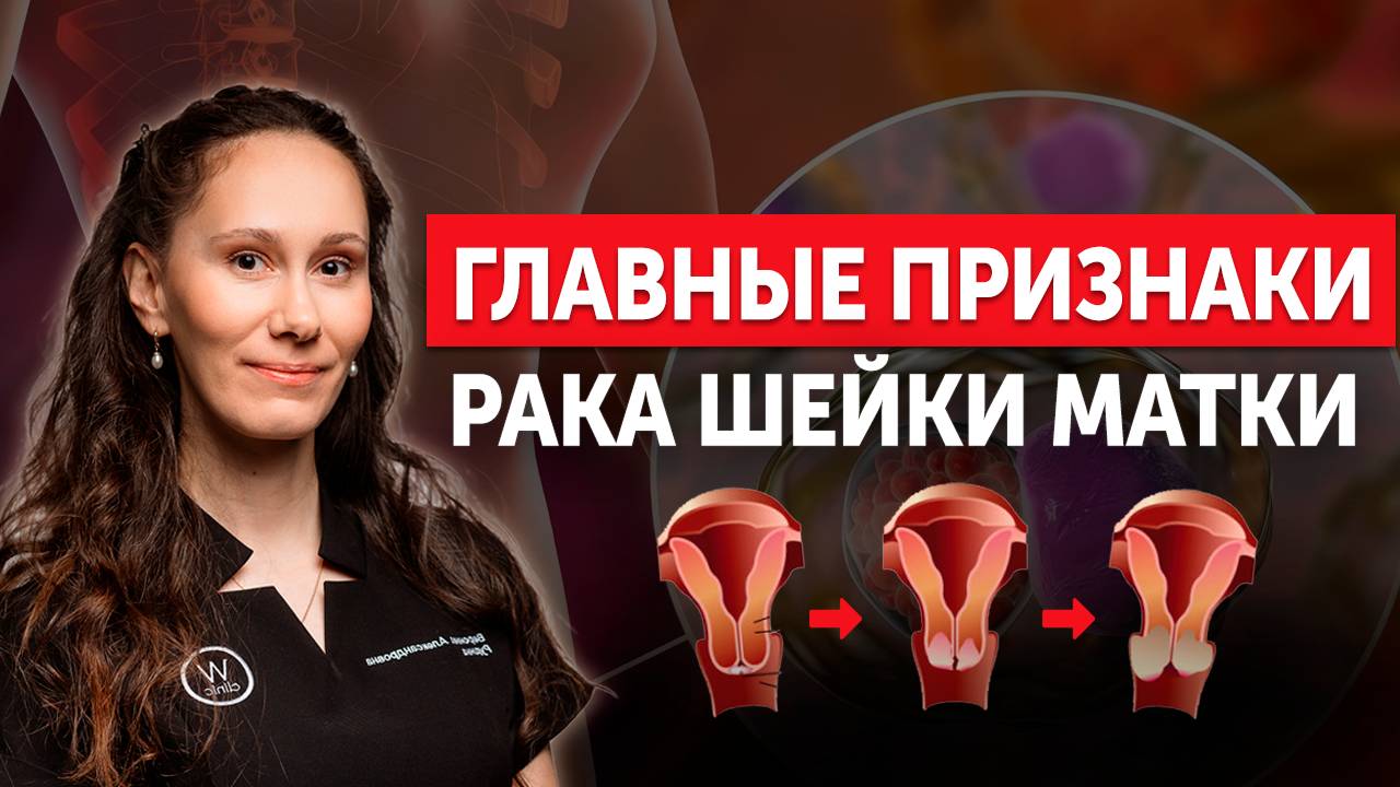 Как распознать рак шейки матки.Эти 3 шага сохранят здоровье.Сделай обследование на ВПЧ смотреть онлайн
