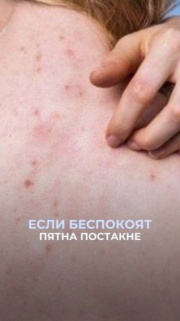 Средства от высыпаний на теле🧴 Ставь лайк, если было полезно 🤍 #косметолог #лечениекожи #высыпания